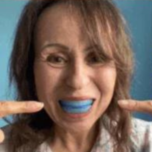 Silensio™ – Protector Bucal Antirronquídos y Antibruxismo