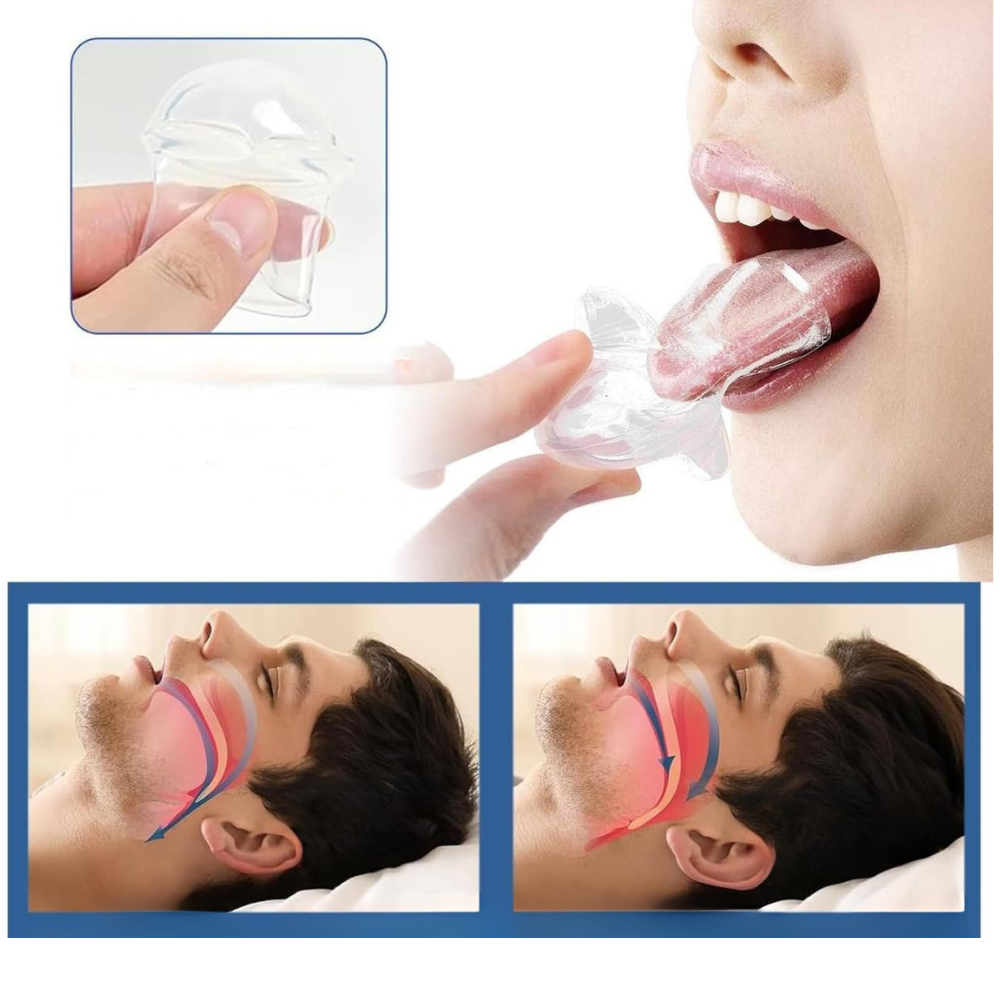 RespiraFácil™ – Dispositivo Antirronquidos de Silicona