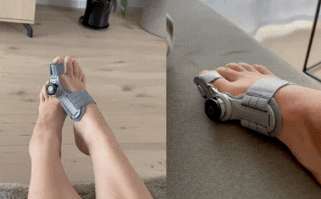 Corrector Ortopédico Ajustable BunionFix™